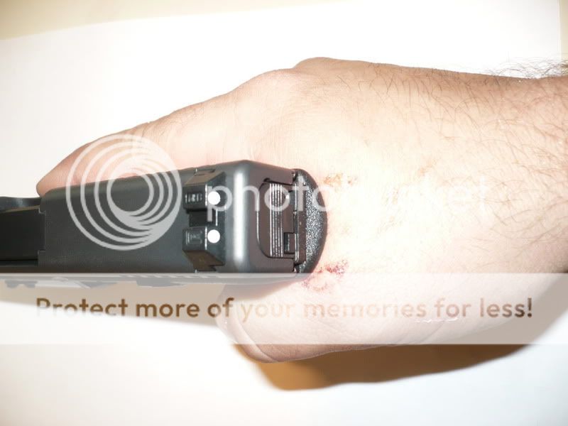 Glock 17 slide bite Topic